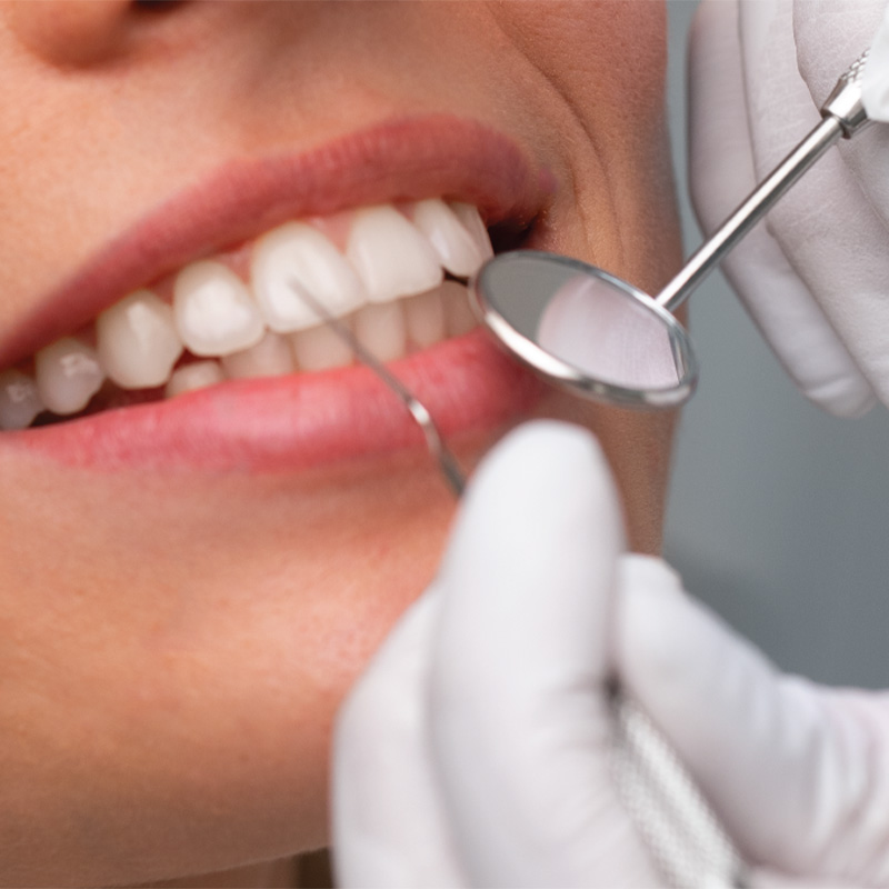 Esthétique Dentaire